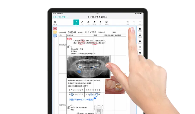 デジタルサブカルテ「Medical Box Note」