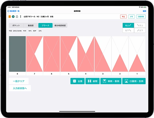 プラーク検査